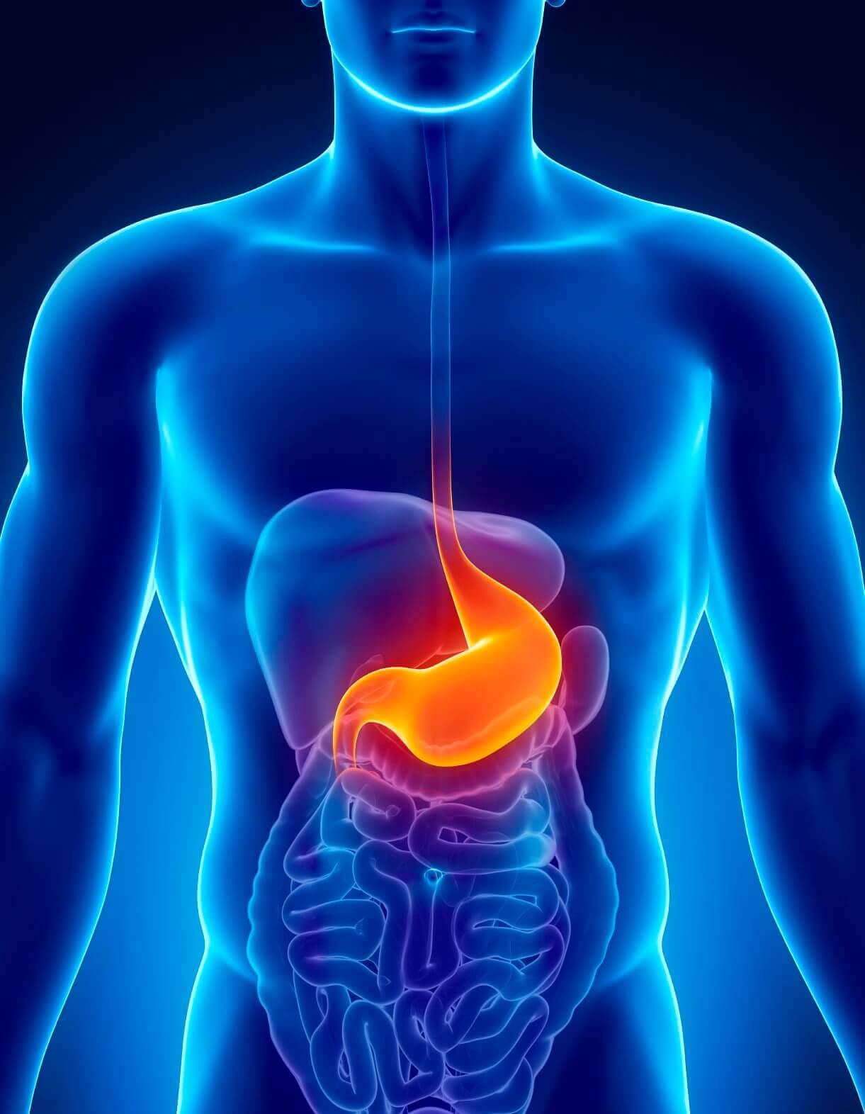 Cirujano de hernia abdominal cerca de Tonalá Jalisco